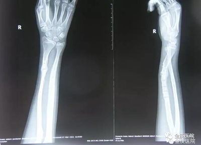 1636611520625793.jpg 4.jpg