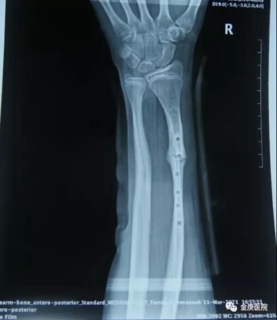 1636611534454935.jpg 6.jpg