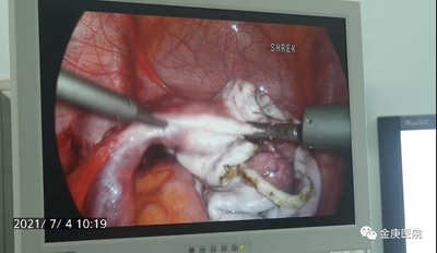 1636613325250243.jpg 2.jpg