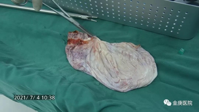 1636613334625080.jpg 3.jpg